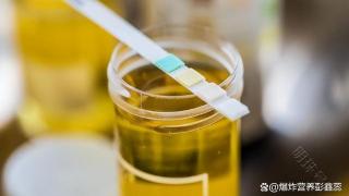 尿液发黄，是不是正常现象？科普小知识