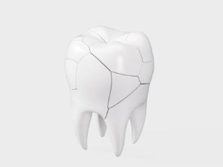 这些伤害牙齿的不良习惯，你中招了吗？