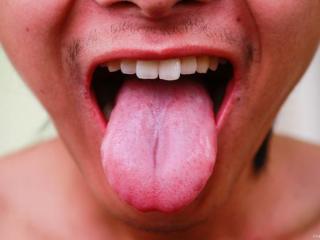 老、嫩舌、胖、瘦舌、裂纹舌、齿痕舌的临床意义