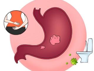 什么是胃痞？它的临床要点是什么？如何预防与防护