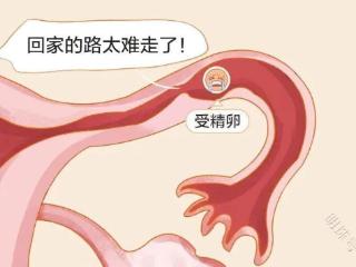 昆明送子鸟：输卵管先天狭窄还可以怀孕吗？有哪些危害？