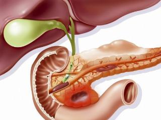 得了胰腺炎怎么饮食调理？饮食上要牢记这“4宜4忌”