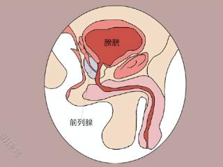 前列腺炎还会导致不育？你还敢忽视吗