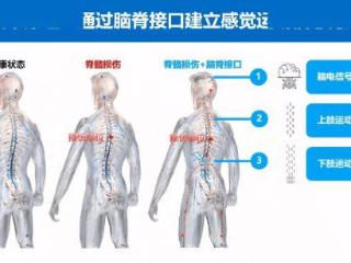 加福民团队开展新一代脑脊接口技术研发