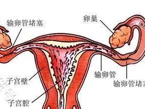 术后还是没怀？这些事你必须知道！