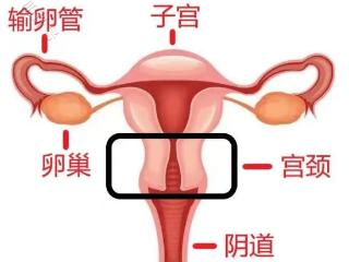 如何预防宫颈性不孕，你可以试试这4个方法