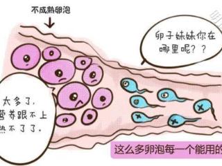 多囊迟迟不怀孕？这3个办法，助你一举得娃！