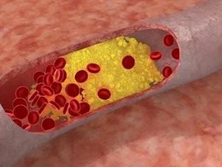 每天走多少步可以保护血管？提醒：养护血管，这5点勿轻易忽视