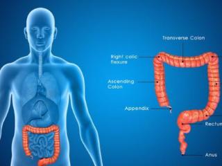 为何患上肠癌的人越来越多？需警惕的是这4个原因