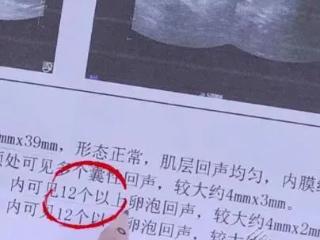 多囊促排一定要先降雄激素吗?