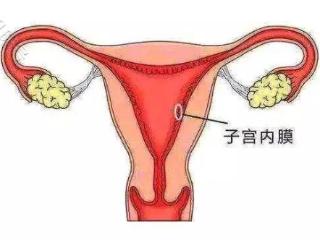 子宫内膜很“矫情”，过厚过薄都不行？