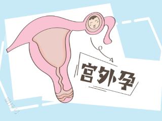 宫外孕：一个藏在身体里的"定时炸弹"