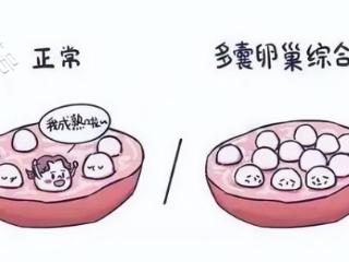 多囊非得要减肥才能怀孕吗？