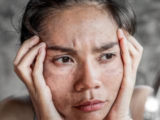 想要肌肤白又亮？掌握美白关键，别忽视维生素C