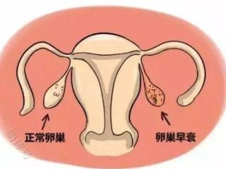 拒绝“卵巢早衰”，应该这样做~