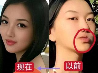 李嫣兔唇痕迹消失，得王菲当妈妈真幸福，帮助她开创不同人生