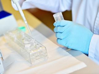 联川生物毛利率下滑：应收账款飙升周转率下降，研发费用率不断走低
