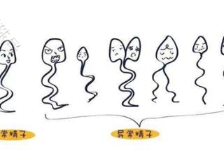 畸形精子：解码精子“颜值”背后的生育真相