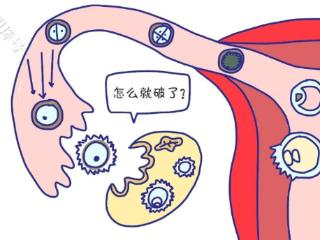 女生注意，突发腹痛很有可能是“黄体破裂”了！