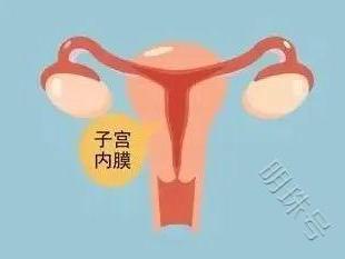 女性的子宫内膜要好好保护