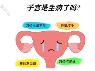 月经不规律，小心是子宫疾病惹的祸!