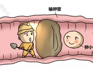 备孕路上的隐形障碍，输卵管堵塞的这些信号要警惕