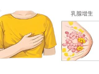 别让乳腺增生成为心结！三步自查+科学管理全攻略