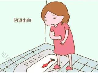 孕早期出血有情况慌了？孕妈妈们先别紧张~