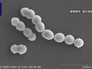 日本链球菌中毒性休克综合征报告激增 30岁以上人群发病率高