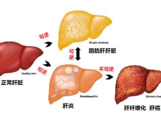 熬夜就是熬肝！LAIFE「乐轻肝」科技配方提升肝脏解毒能力