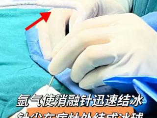 成都中医哮喘医院《消融治疗肺结节118例临床分析》研究报告成功刊发