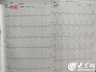 玲珑英诚医院：警惕特殊类型的急性心肌梗死——De Winter综合征