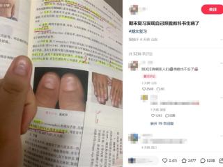 女生从教科书上发现自己生病了：考虑去医院看看