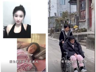 女生确诊渐冻症一年容貌巨变：吞咽都要尽全力