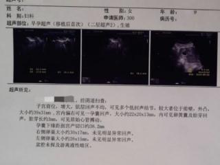 家恩德运生殖中心：卵巢功能接近枯竭的40＋的夫妻还能圆梦二胎吗？