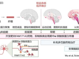 全球首次！复旦团队发现帕金森全新治疗靶点：AI大显身手