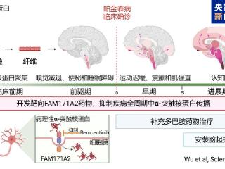 全球首次！复旦大学科研团队发现帕金森病全新治疗靶点