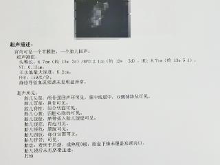 青岛妇儿医院新推出孕11~13+6周胎儿Ⅱ级超声检查项目