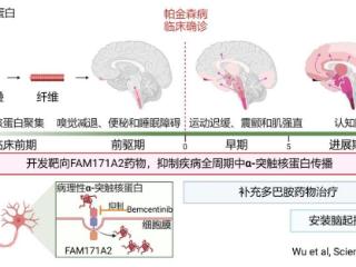 我国科学家发现帕金森病治疗新靶点