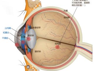 节后血糖波动引发眼疾，济南眼科医院提醒糖尿病患者注重眼底健康