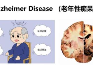 迪安诊断晓飞检与环球细胞库达成老年痴呆防治战略合作