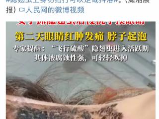 有人因此“毁容”！遇到这种虫子千万不能拍