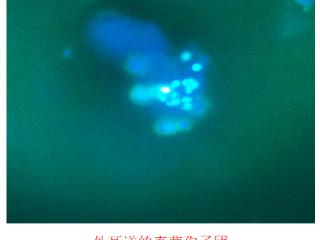 耳朵瘙痒总不好？专家：可能是真菌感染而非湿疹
