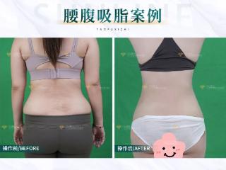 杏林整形：专门胖肚子的五个坏习惯！你中招了几个？