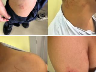 天津10岁儿童疑遭培训机构老师殴打，警方已介入调查
