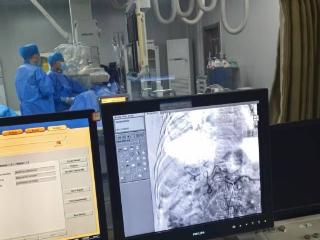 曹县中医医院成功开展首例肝动脉化疗栓塞术