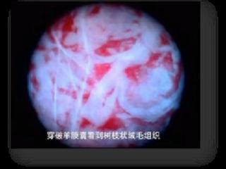 流产后“小月子”如何科学休养？妇科多举措保护女性生育力