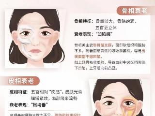 杏林整形医院：垮脸“重灾区”盘点